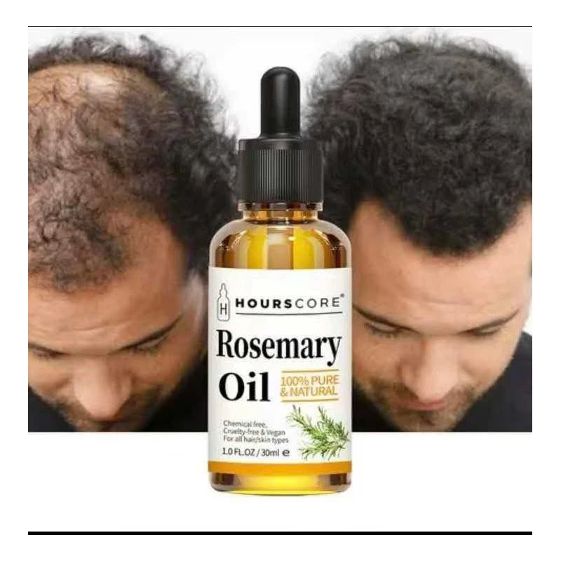 crm/additional_product_images/rosemary oil 2.webp